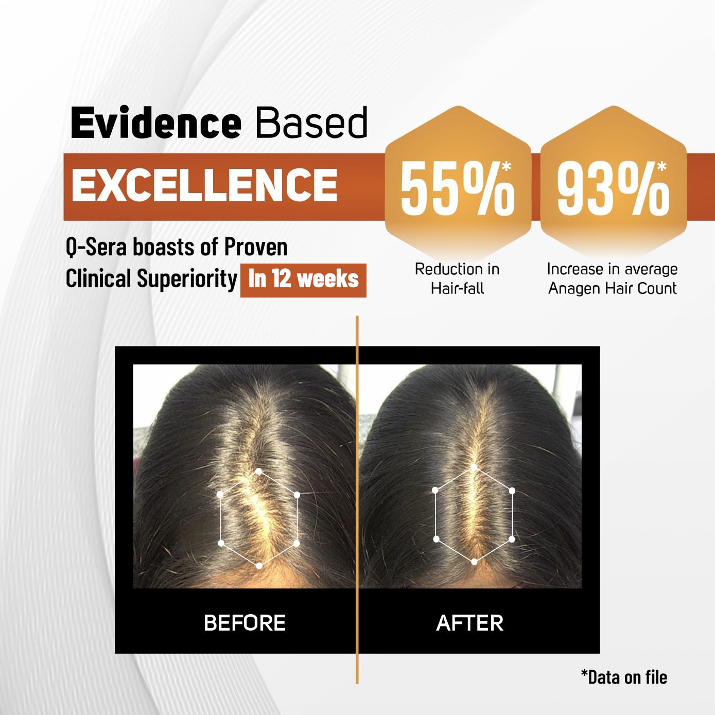 Q-Sera Hair Serum 60ml for Thick Hair | With Milk Based Anti-Inflanes F- image 7