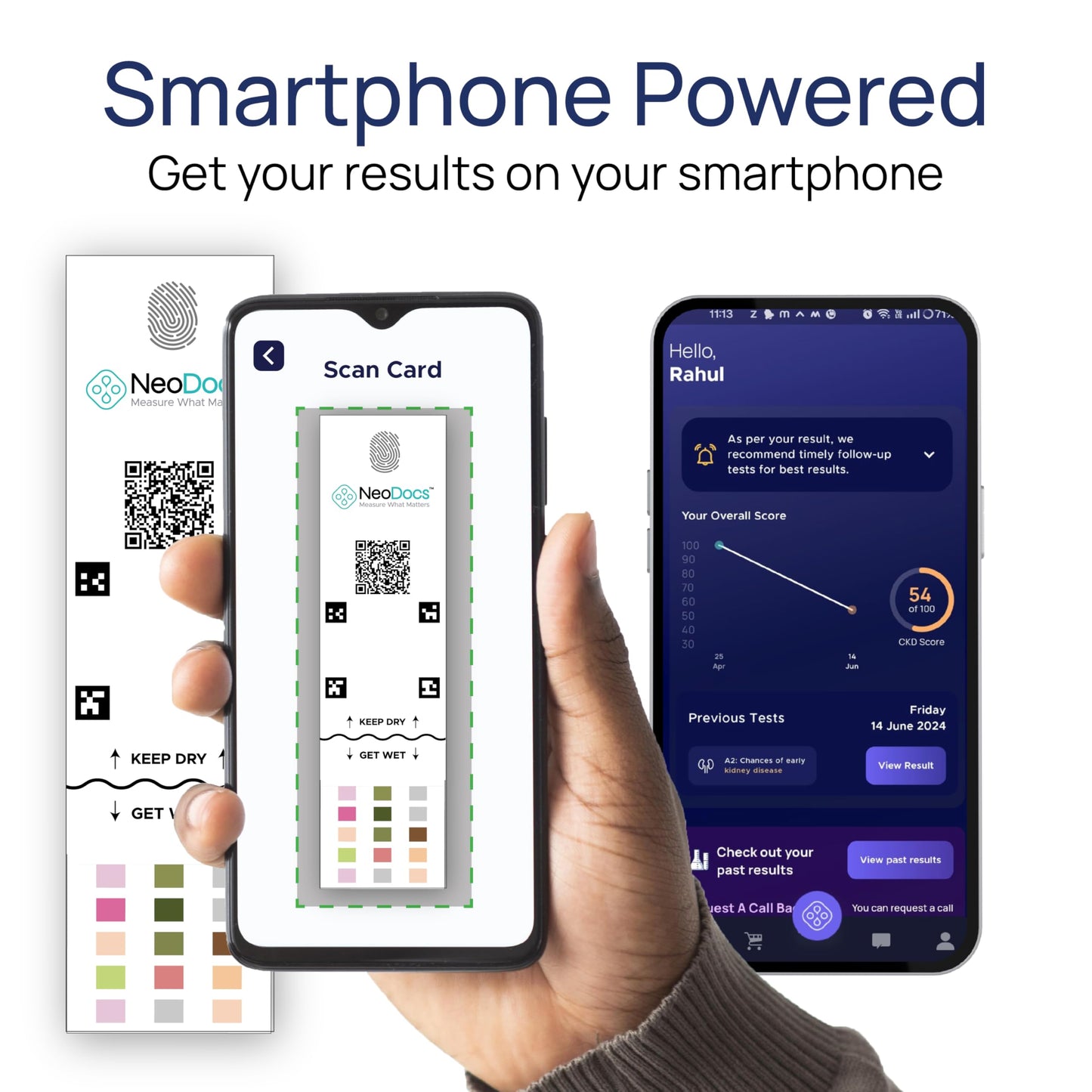 Neodocs Kidney wellness Urine test | Pack of 1- image 7