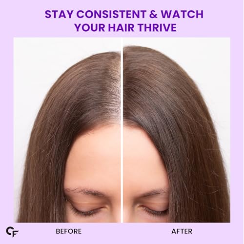 Carbamide Forte Biotin for Hair Growth with Amla, Brahmi & Bamboo Extra- image 7