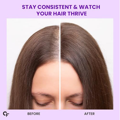 Carbamide Forte Biotin for Hair Growth with Amla, Brahmi & Bamboo Extra- image 7