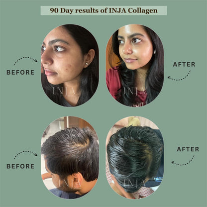 INJA Prime Marine Collagen Supplement Powder for Women and Men, Japanese Collagen with Original Formulation, Healthy Skin, Joints, Hair Growth, Sugar-Free, Unflavoured, 125 gm