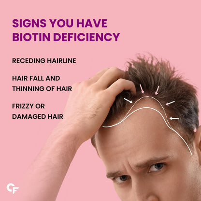 Carbamide Forte Biotin Tablets for Hair Growth | Biotin Supplement 10000 mcg | Hair Supplements for Women & Men | 60 Hair Growth Tablets