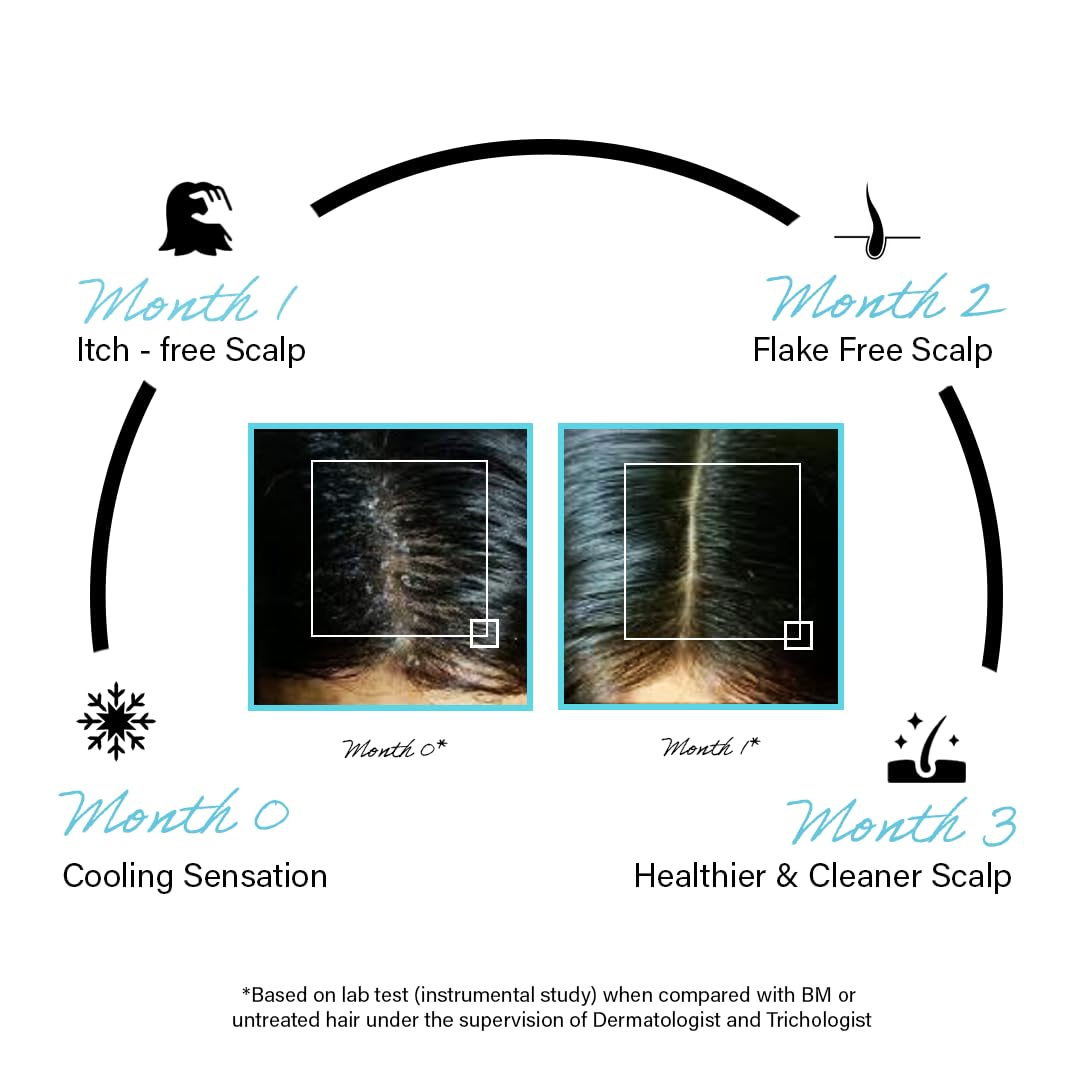 Rootcos Salicylic Acid Anti-Dandruff Serum with Piroctone Olamine | Sca- image 8