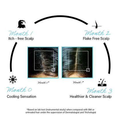 Rootcos Salicylic Acid Anti-Dandruff Serum with Piroctone Olamine | Sca- image 8