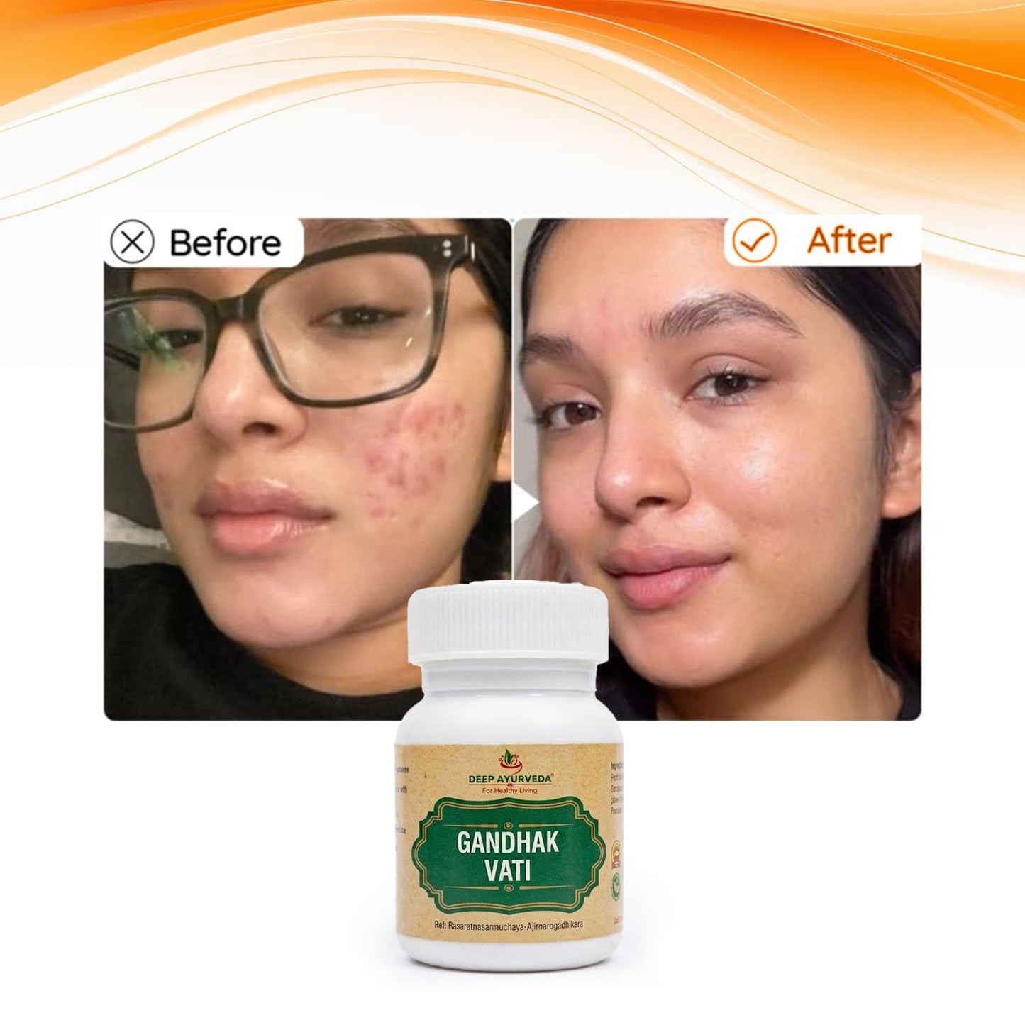 Gandhak Vati | Ayurvedic Herbal Supplement for Skin Wellness, Detox Support & Digestive Health | Supports Natural Immunity & Overall Wellness | 40 Tablets