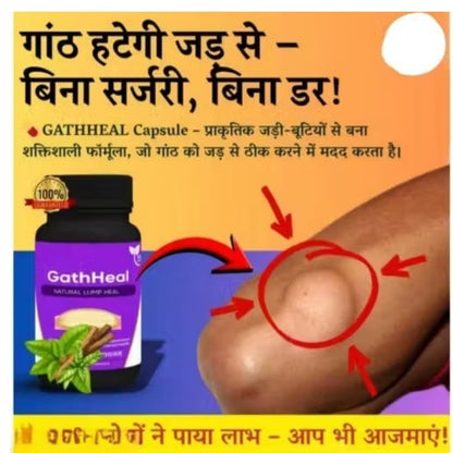 Vanya Root GathHeal Natural Lump Heal Supplement | Ayurvedic Herbal Wellness Formula for Overall Health Support | Premium Herbal Dietary Supplement | (Pack Of 60 Capsules)