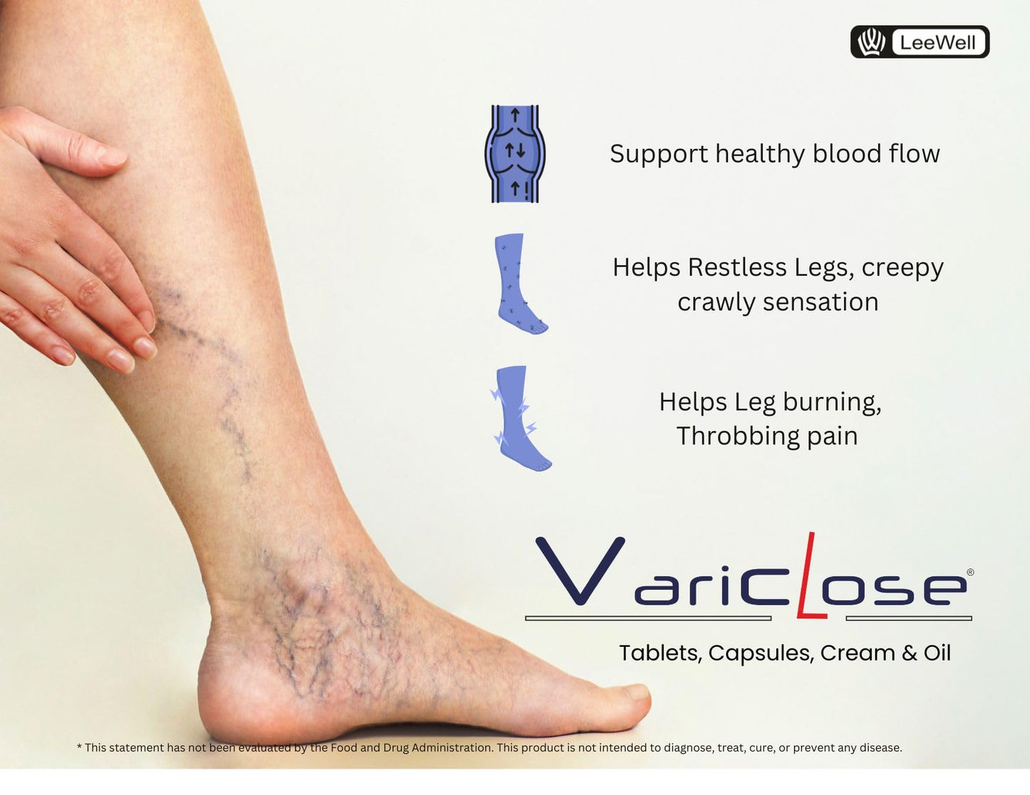 Variclose -500 Advanced Support for Varicose Veins | Helps Strengthens Vein Wall & Improve Micro Circulation | Plant-based Nutrition for Restless Legs Health & Enlarged Vein discomfort | Citrus bioflavonoids Diosmin 450mg Hesperidin 50mg - 30 tablets