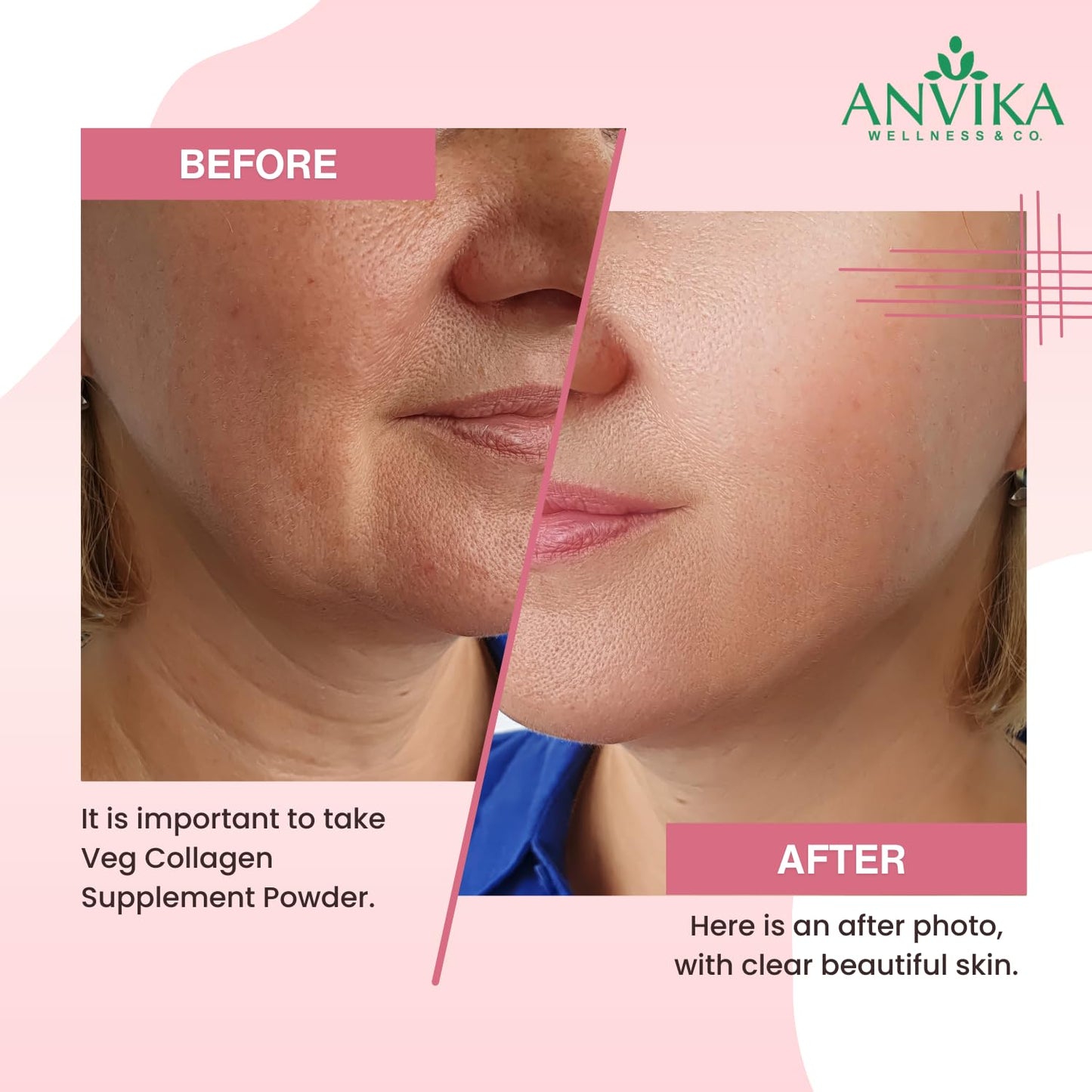 Anvika Veg Collagen Powder | Plant-Based Collagen Builder for Hair, Skin & Nails | Strawberry Flavor | 150g | Supports Skin Elasticity | Hair Growth & Joint Health