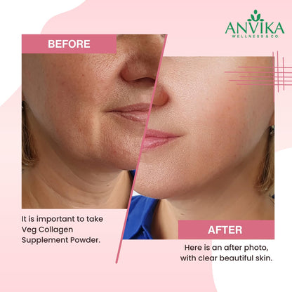 Anvika Veg Collagen Powder | Plant-Based Collagen Builder for Hair, Skin & Nails | Strawberry Flavor | 150g | Supports Skin Elasticity | Hair Growth & Joint Health