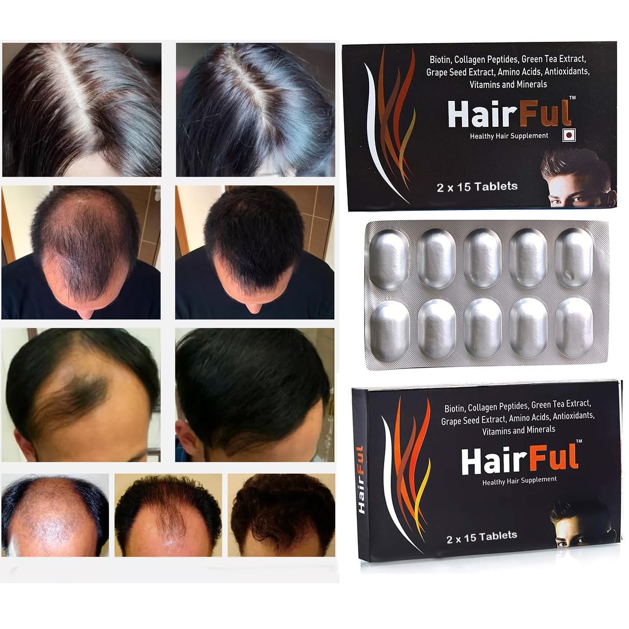 HairFul Biotin Tablet | Hair Growth Vitamins Supplement | Biotin Tablets for Hair Skin and Nails Vitamins | for Women and Men (15 X 2) 30 Tablets (Pack of 2)