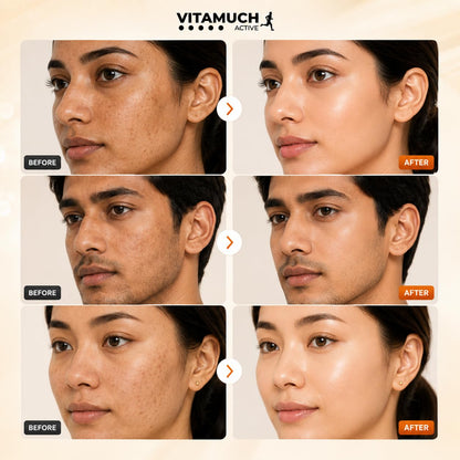 Vitamuch Glow Fizz | Glutathione Effervescent Tablets for Skin Brightening & Anti-Aging | With Hyaluronic Acid & Vitamin C | Drop, Fizz & Drink Formula | (15 Days(Pack of 1), Orange)