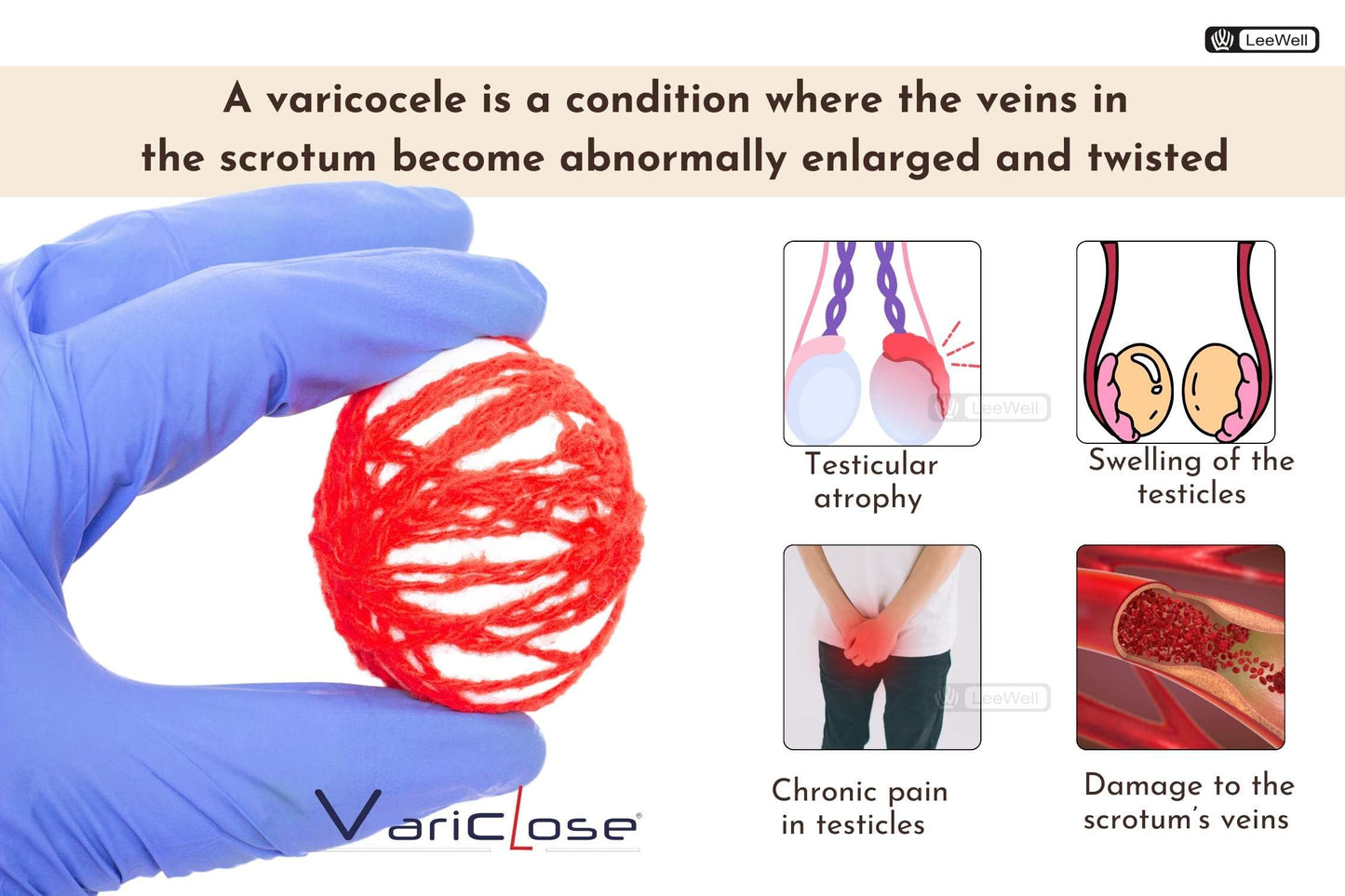 Variclose Vein, Spider Veins - 60 Capsules- image 3