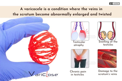 Variclose Vein, Spider Veins - 60 Capsules- image 3