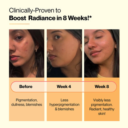 Setu Skin Renew Glutathione Tablets for Glowing Skin | 15 Effervescent- image 5