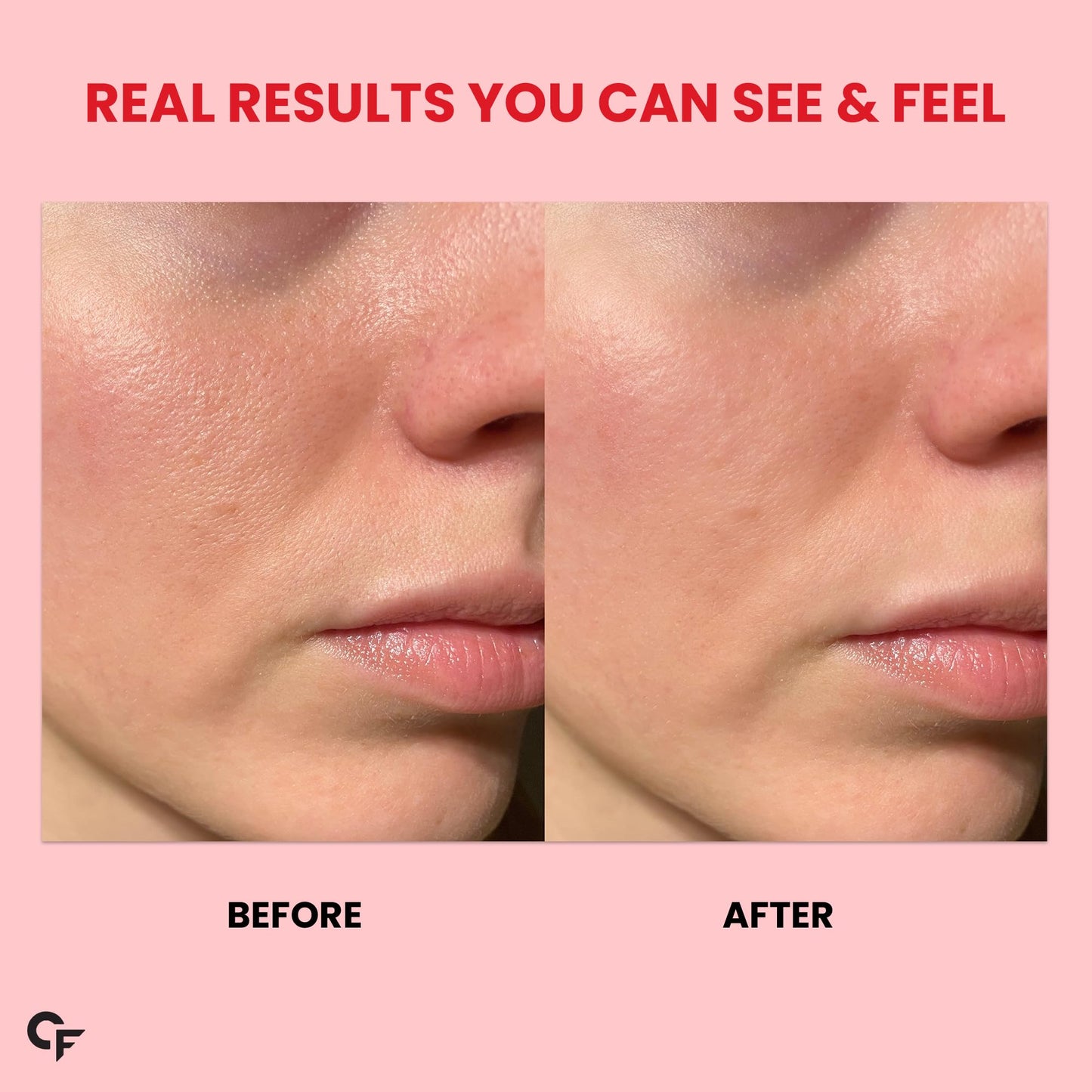 Carbamide Forte 100% Veg Collagen Builder, 90 Tablets | Plant Based Col- image 4