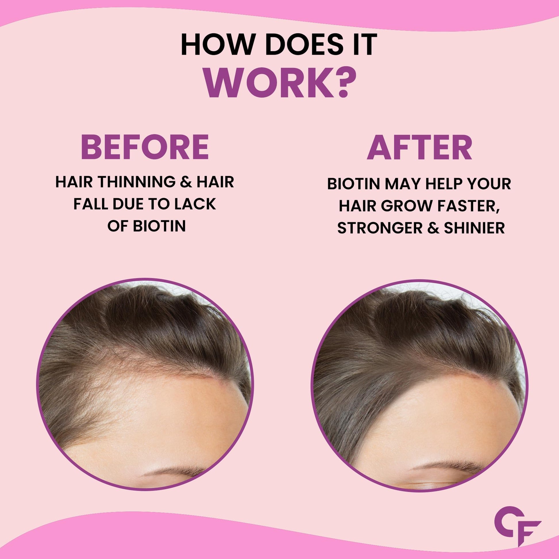 Carbamide Forte Biotin Supplement with 50 Multivitamin Ingredients for- image 5