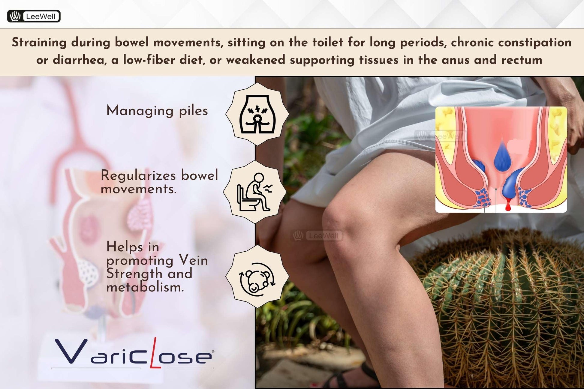 Variclose Vein, Spider Veins - 60 Capsules- image 6