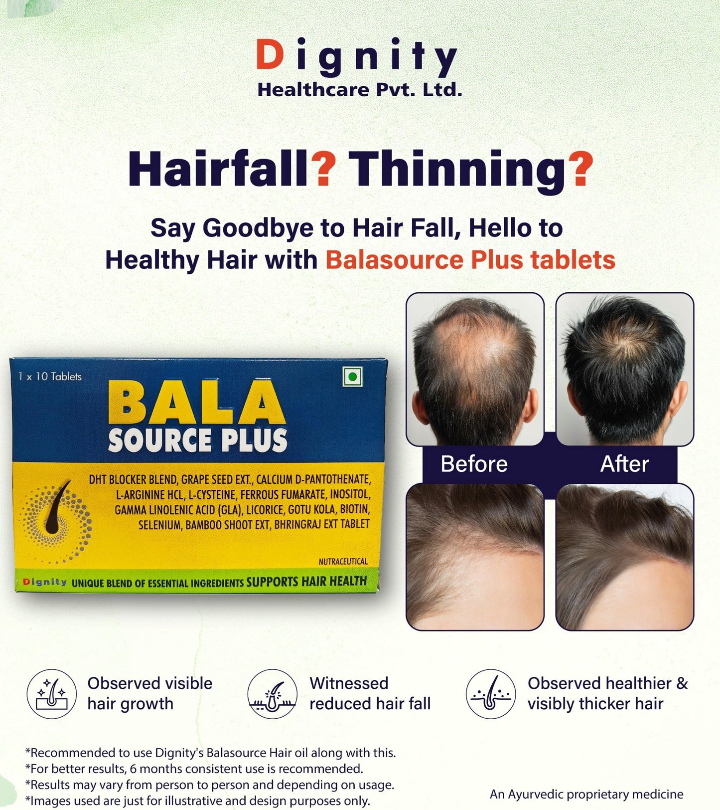 Balasource Plus Tablets | Hair Health Supplement with Biotin, DHT Blocker, Vitamins, Minerals & Herbal Extracts | Supports Strong, Thick & Healthy Hair Growth | 10 Tablets