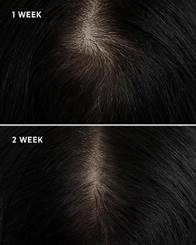 Lavister Advanced Hair Growth Serum - Control Hair Fall in 1 Week - Triple Action on Hair with Anaga Formula - Hair Growth Serum for Men & Women 50 ml