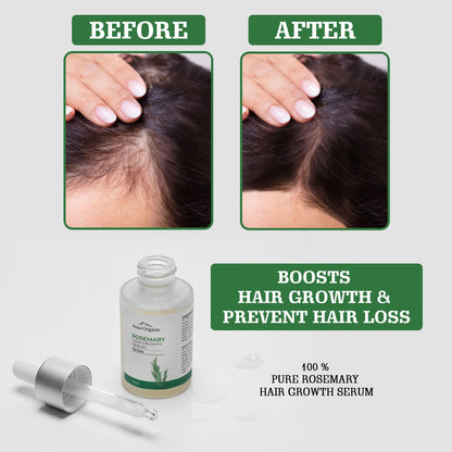 Aravi Organic Rosemary Biotin Hair Growth Serum - Boosts Natural Hair Growth, Strengthens Strands, and Nourishes Scalp